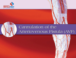 cover of cannulation video